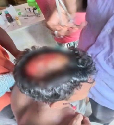 Landowner Attacked by Armed Assailants