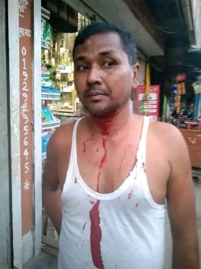 Terrorist Attack on Ratan Chandra Mohonto