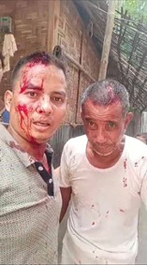 Violent Attack on RAB Member’s Family